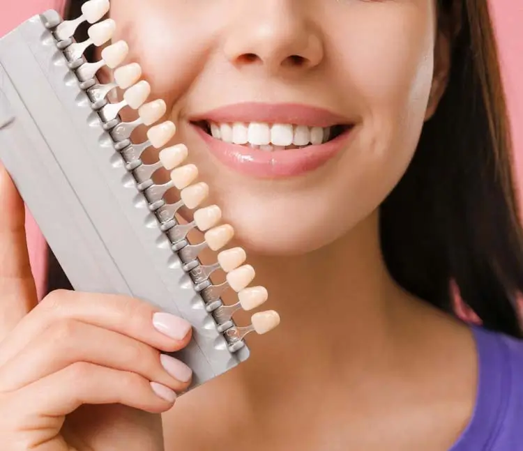 Detailaufnahme: Veneers zum Farbabgleich neben l&auml;chelnden Mund gehalten 